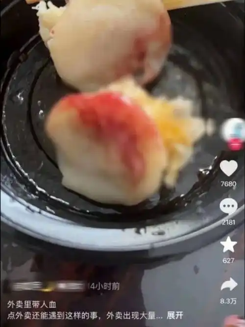 外卖吃出血事件震惊全网！体坛“血染赛场”数据榜单揭晓